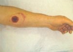 Mike's_Arm1.JPG