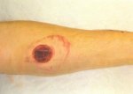 Mike's_Arm2.JPG
