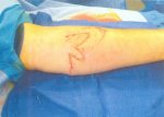 Mike's_Arm4.JPG