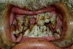 really_bad_teeth[1].jpg